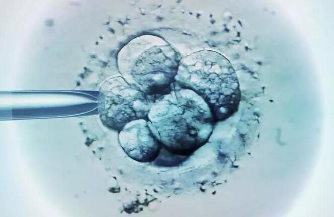 胚胎的等级是如何划分的呢？宫腔镜检查对于试管的意义？