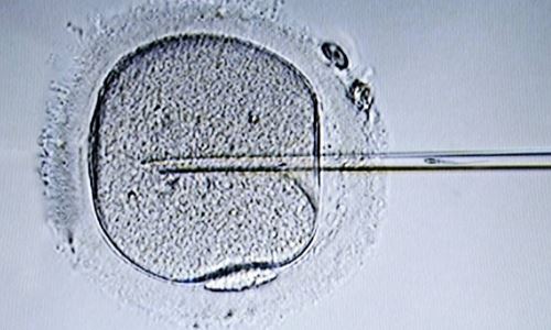 养囊过程：从受精到胚胎的奇妙